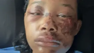 Black Lesbian Couple in Virginia Survives Brutal Attack Now Investigated as Potential Hate Crime