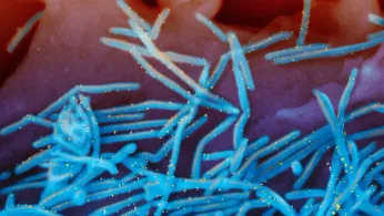 Winter Virus Season So Far Is Not Too Bad, But Doctors Worry About Suffering to Come